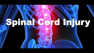 Spinal Cord Injury Attorneys in California